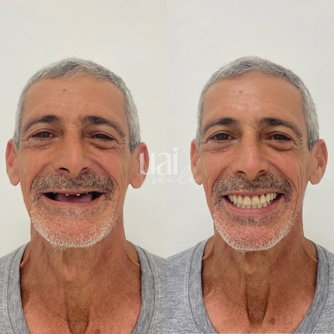 ✨Nunca desista dos seus sonhos!🥺Joel estava há 40 anos sem se alimentar corretamente pela falta